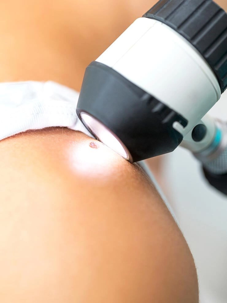 Home Dermascope